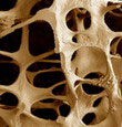 Остеопороз, Тест на приверженность остеопорозу